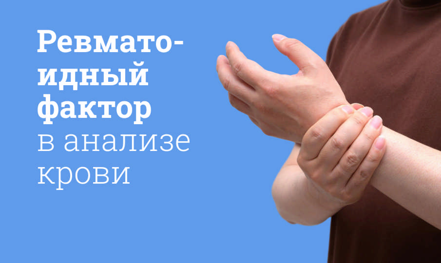 Ревматоидный фактор в анализе крови