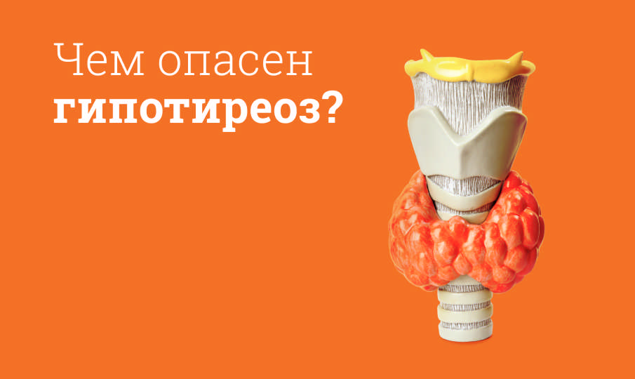 Гипотиреоз: симптомы, причины, лечение