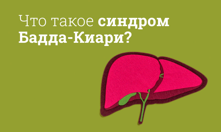 Синдром Бадда-Киари