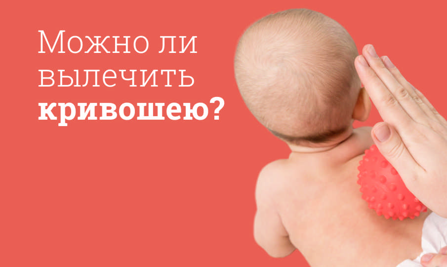 Что такое кривошея?