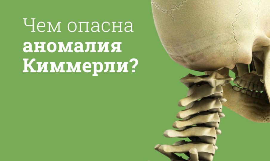 Что такое аномалия Киммерли простыми словами?