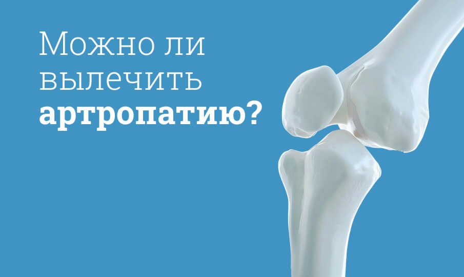Артропатия суставов